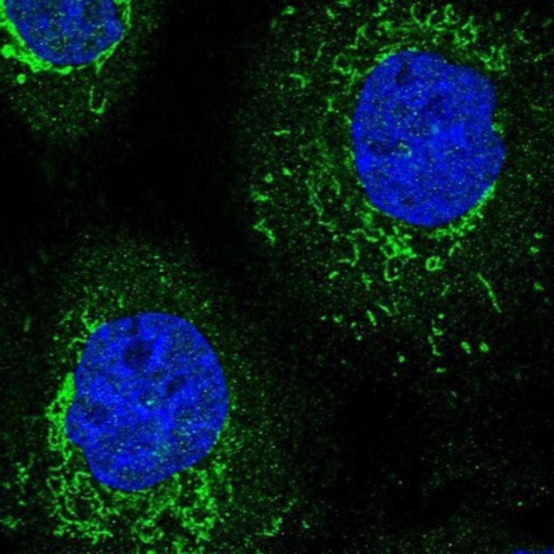 Immunocytochemistry/Immunofluorescence: TRNT1 Antibody [NBP1-86589] - Staining of human cell line A-431 shows positivity in mitochondria.