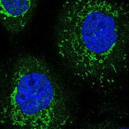 Immunocytochemistry/Immunofluorescence: TRNT1 Antibody [NBP1-86589] - Staining of human cell line A-431 shows positivity in mitochondria.