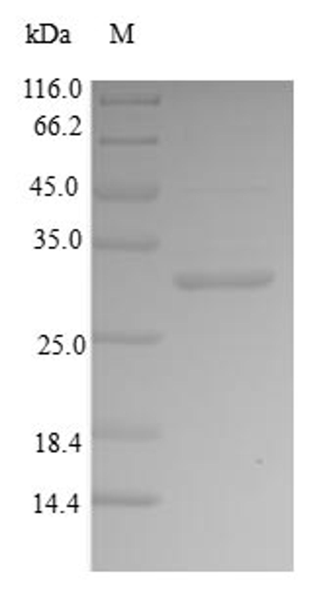 (Tris-Glycine gel) Discontinuous SDS-PAGE (reduced) with 5% enrichment gel and 15% separation gel.