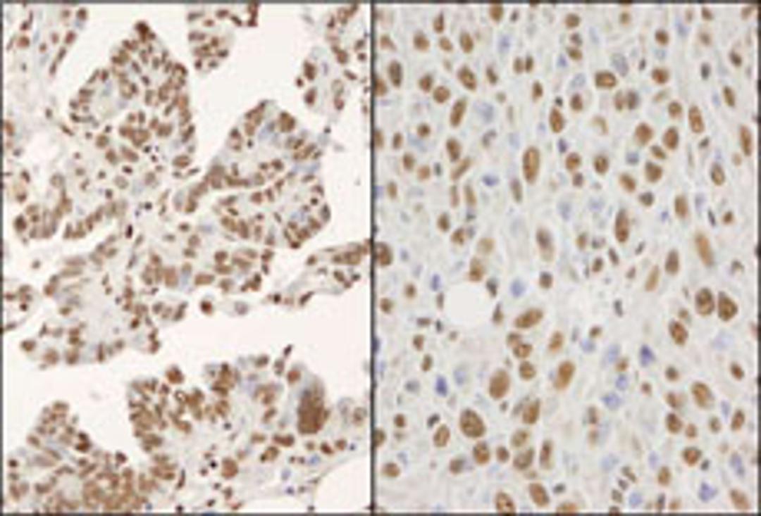 Detection of human and mouse hnRNP-K by immunohistochemistry.