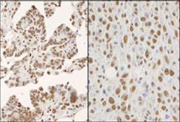 Detection of human and mouse hnRNP-K by immunohistochemistry.