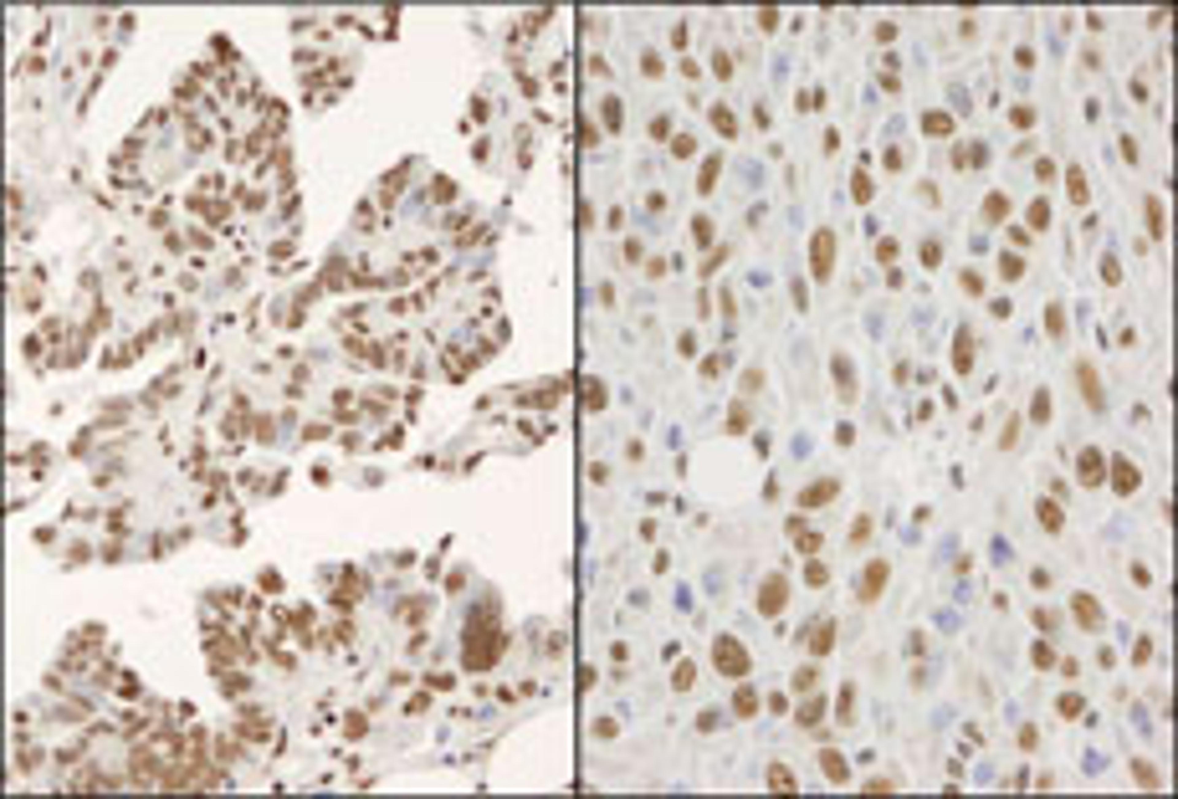 Detection of human and mouse hnRNP-K by immunohistochemistry.