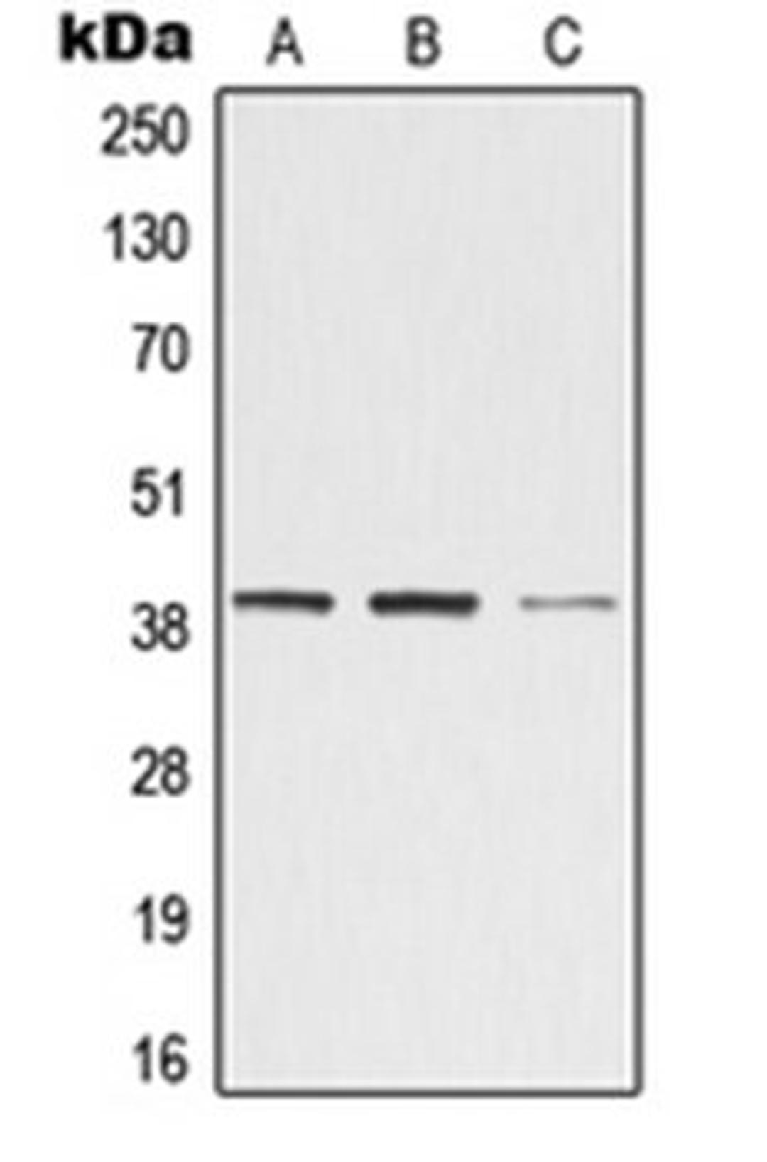 Western blot analysis of Jurkat (Lane 1), Raw264.7 (Lane 2), rat kidney (Lane 3) whole cell lysates using ZADH2 antibody