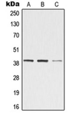 Western blot analysis of Jurkat (Lane 1), Raw264.7 (Lane 2), rat kidney (Lane 3) whole cell lysates using ZADH2 antibody