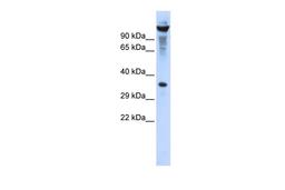 Antibody used in WB on Human HEK293T cells at 0.2-1 ug/ml.