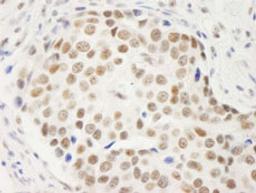 Detection of human Symplekin by immunohistochemistry.