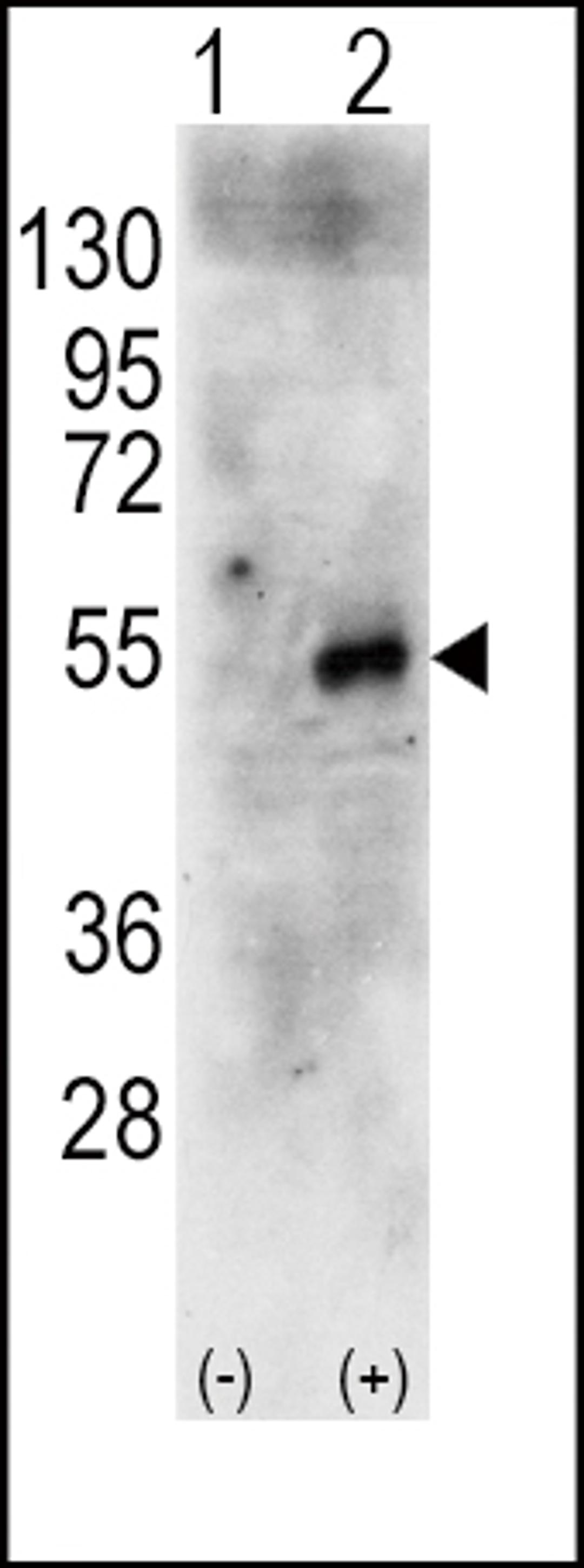 Western blot analysis of RPS6KB2 using rabbit polyclonal RPS6KB2 Antibody using 293 cell lysates (2 ug/lane) either nontransfected (Lane 1) or transiently transfected with the human RPS6KB2 gene (Lane 2).