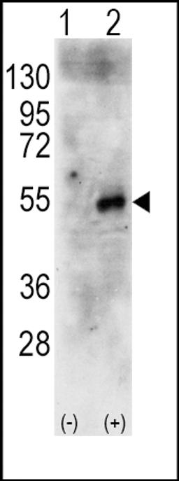 Western blot analysis of RPS6KB2 using rabbit polyclonal RPS6KB2 Antibody using 293 cell lysates (2 ug/lane) either nontransfected (Lane 1) or transiently transfected with the human RPS6KB2 gene (Lane 2).