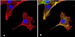 Immunocytochemistry/Immunofluorescence: MAPKAPK2 [p Thr2334] Antibody (9F10.2) [NBP2-29677] - NIH/3T3 cells were fixed, permeabilized, and stained using Anti-phospho-MAPKAPK2 (Thr334), clone 9F10.2 (Red). Cells were co-stained for actin and nuclear staining with Phalloidin, AlexaFluor 488 conjugate (Green) and DAPI (Blue), respectively.