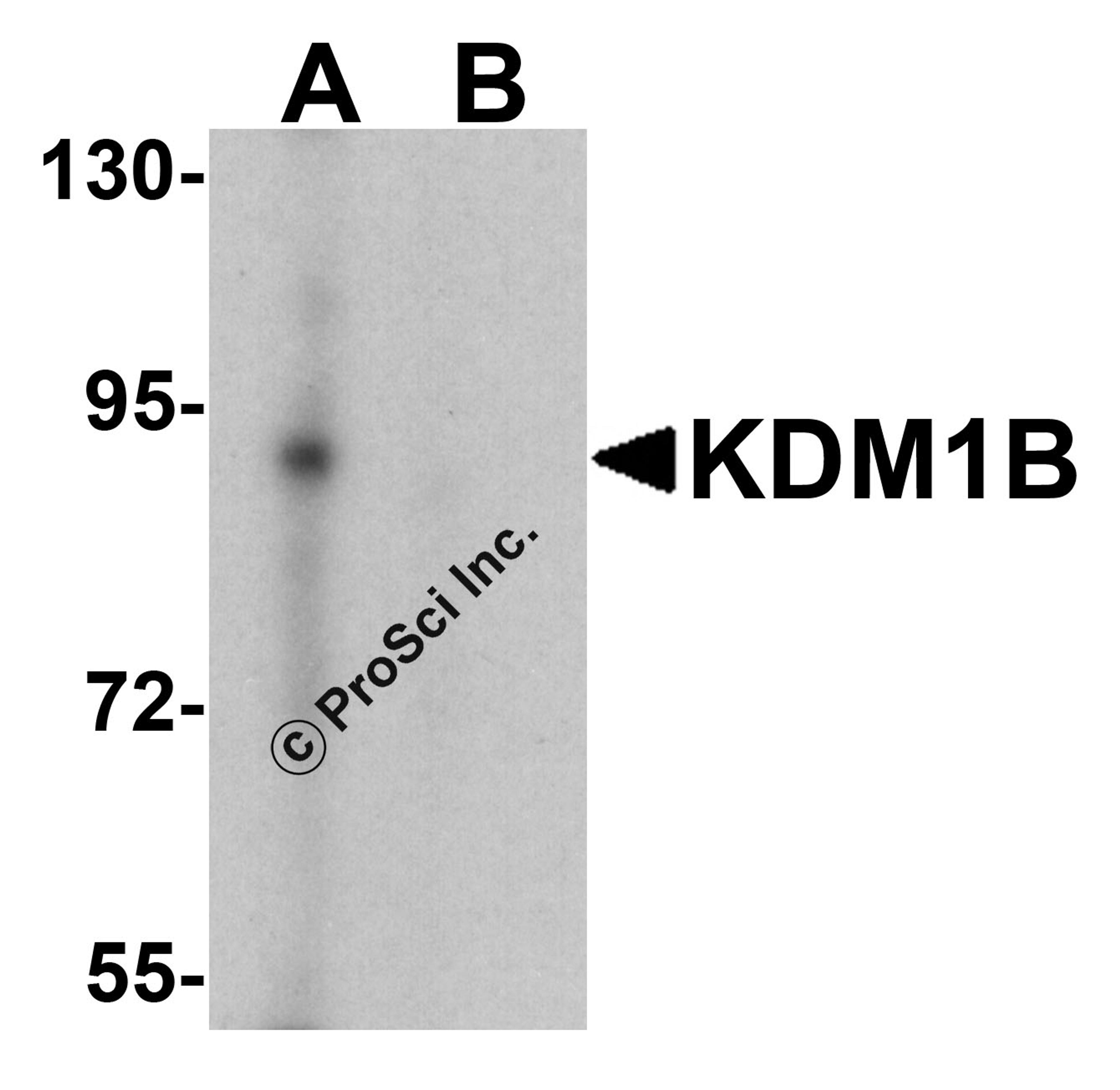 Western blot analysis of KDM1B in K562 cell lysate with KDM1B antibody at 0.5 &#956;g/ml in (A) the absence and (B) the presence of blocking peptide 