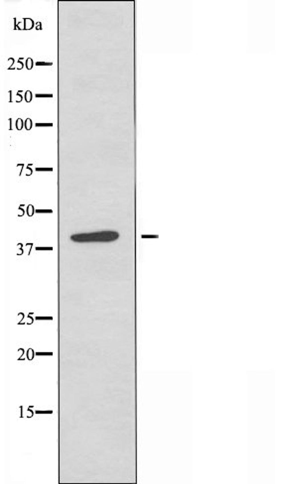 Western blot analysis of RAW264.7 cells using PHLA1 antibody