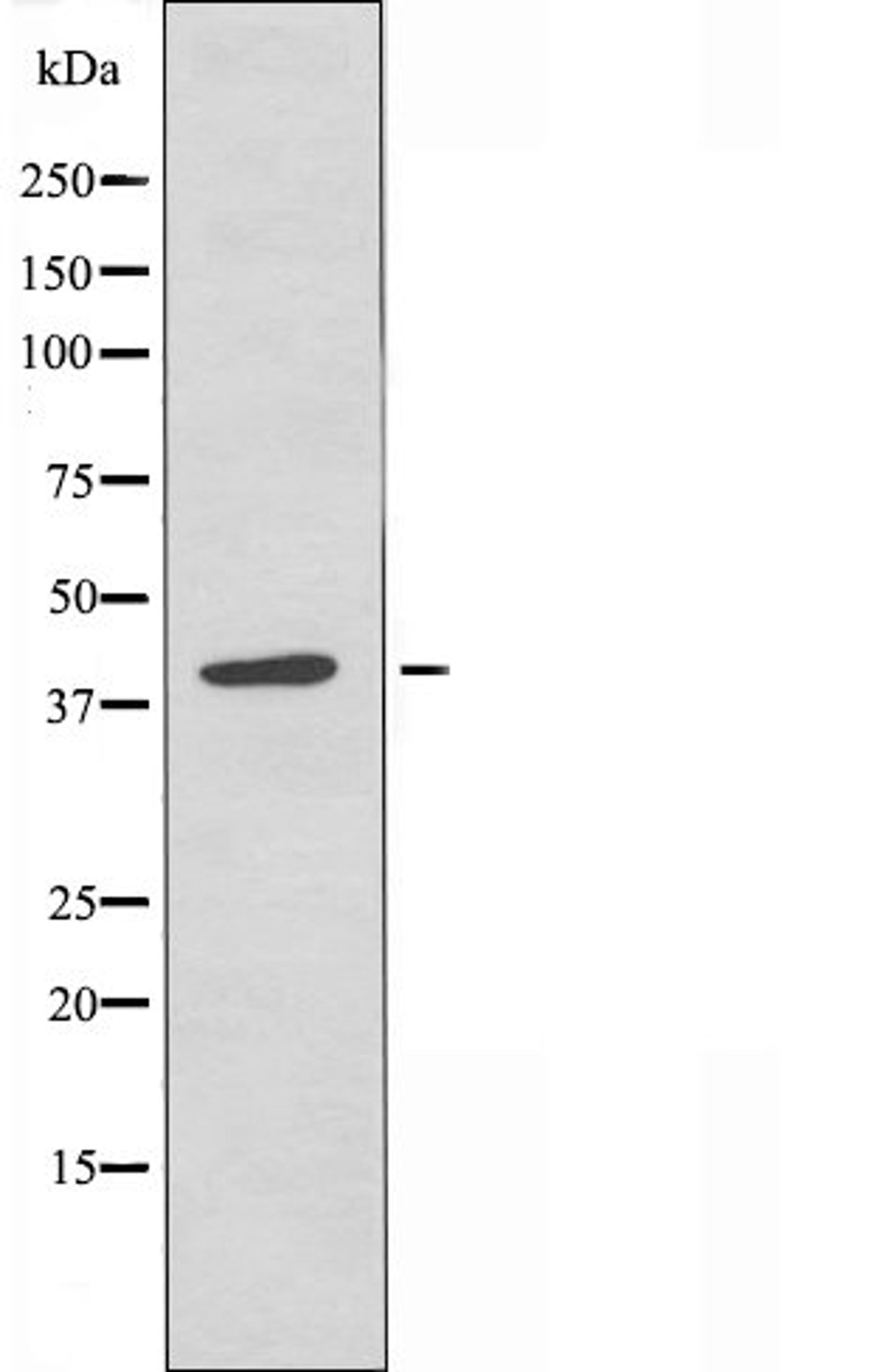 Western blot analysis of RAW264.7 cells using PHLA1 antibody