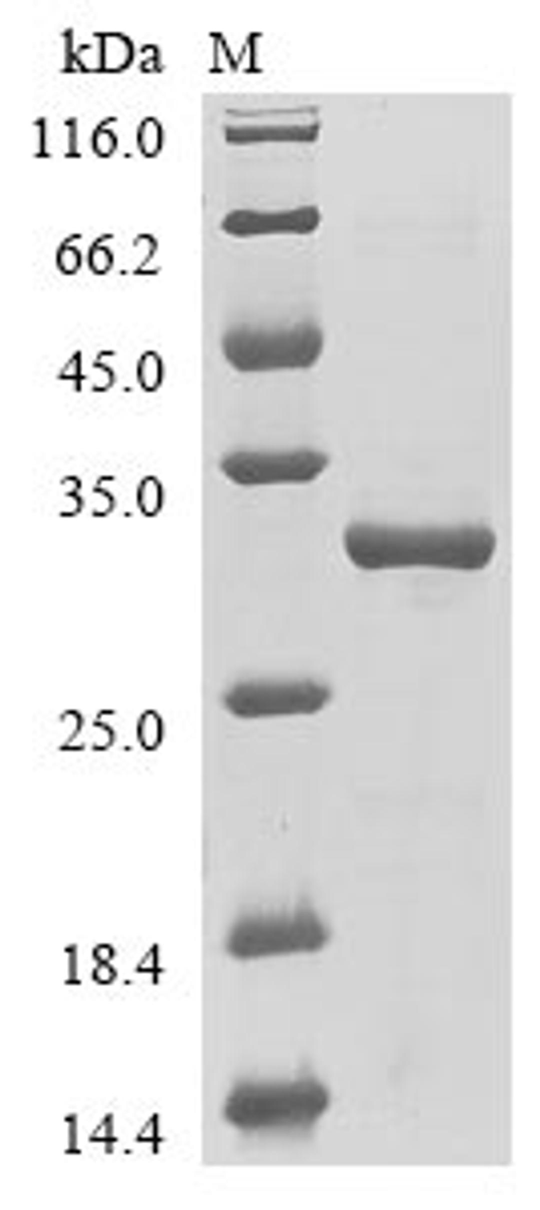(Tris-Glycine gel) Discontinuous SDS-PAGE (reduced) with 5% enrichment gel and 15% separation gel.