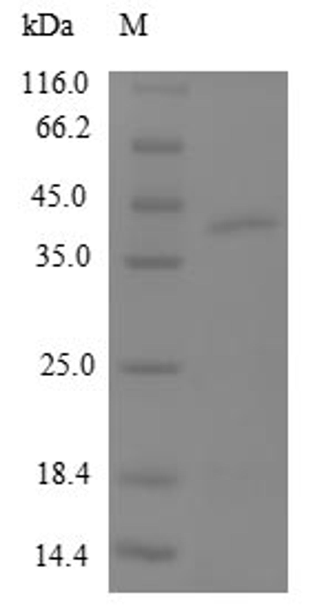 (Tris-Glycine gel) Discontinuous SDS-PAGE (reduced) with 5% enrichment gel and 15% separation gel.