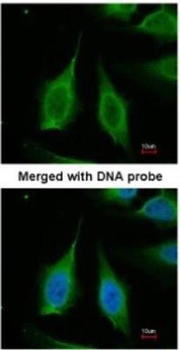 Immunocytochemistry/Immunofluorescence: Inorganic Pyrophosphatase/PPA1 Antibody [NBP1-31348] - Paraformaldehyde-fixed HeLa, using antibody at 1:200 dilution.