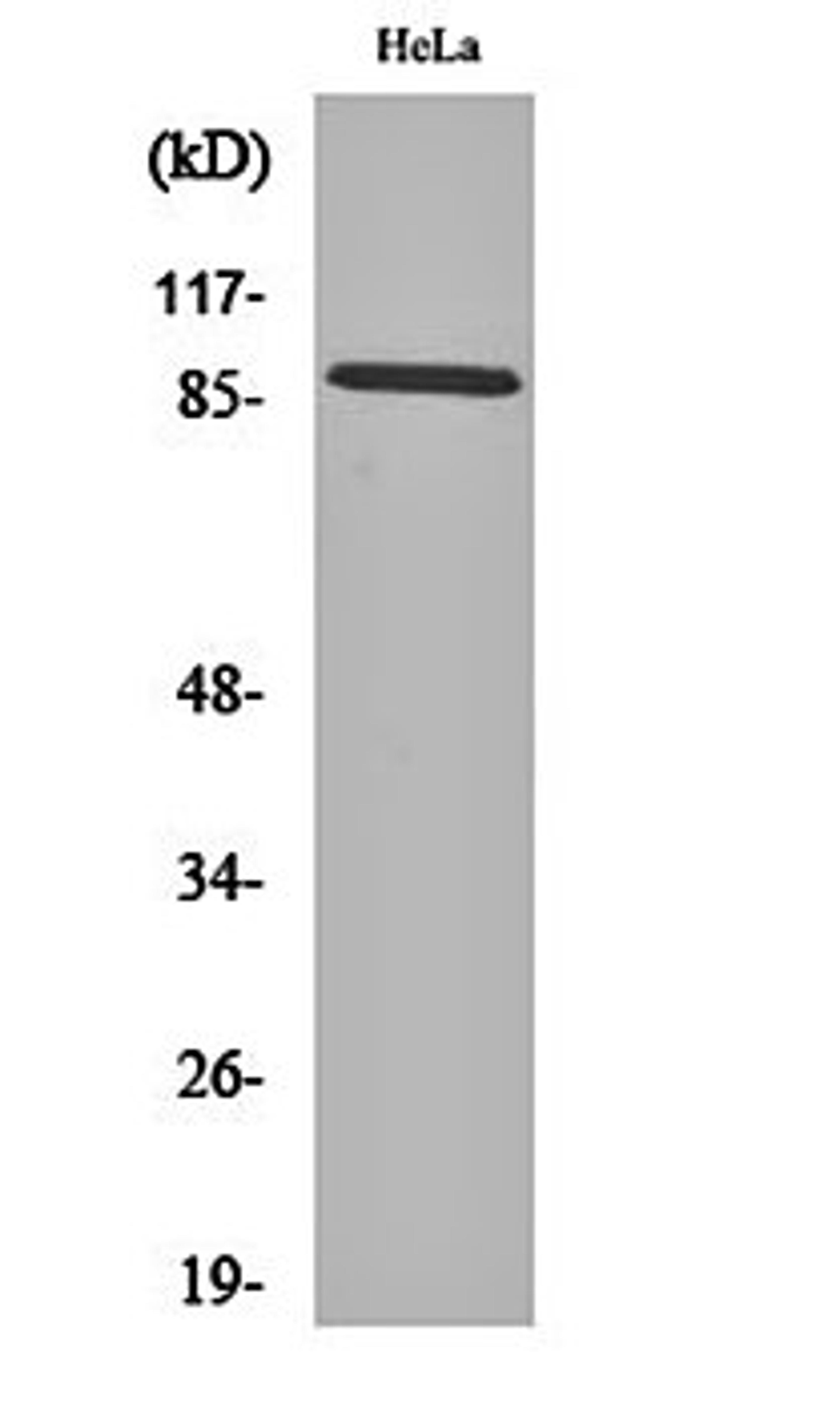 Western blot analysis of Hela cell lysates using Cadherin-18 antibody