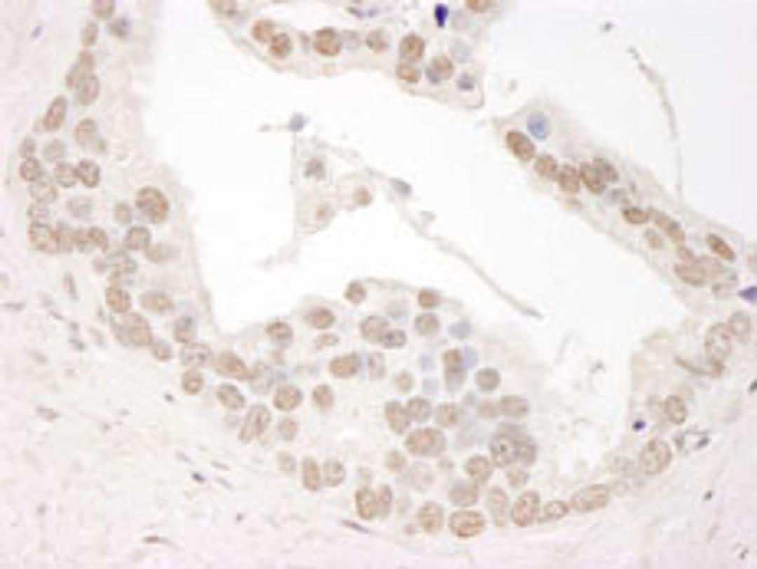 Detection of human Cyclin L1 by immunohistochemistry.