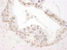 Detection of human Cyclin L1 by immunohistochemistry.