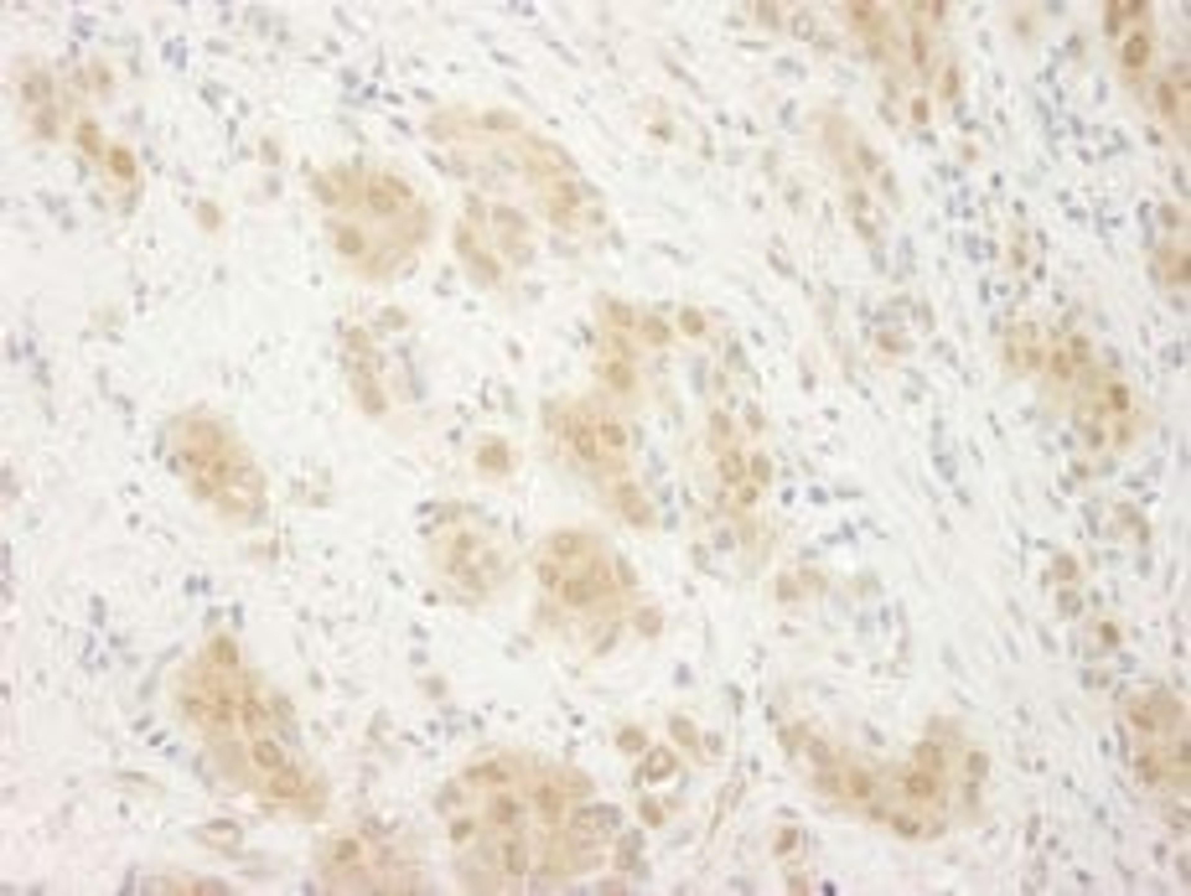 Detection of human ERK2 by immunohistochemistry.