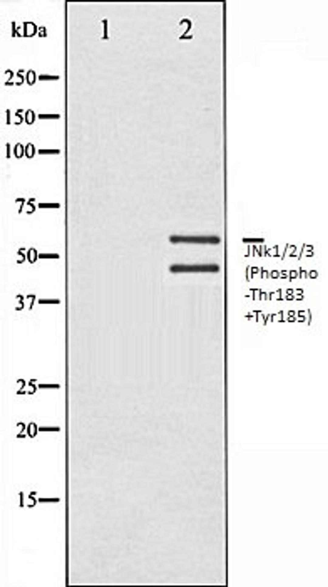 Western blot analysis of 293 whole cell lysates using JNK1/2/3 (Phospho-Thr183+Tyr185) antibody, The lane on the left is treated with the antigen-specific peptide.