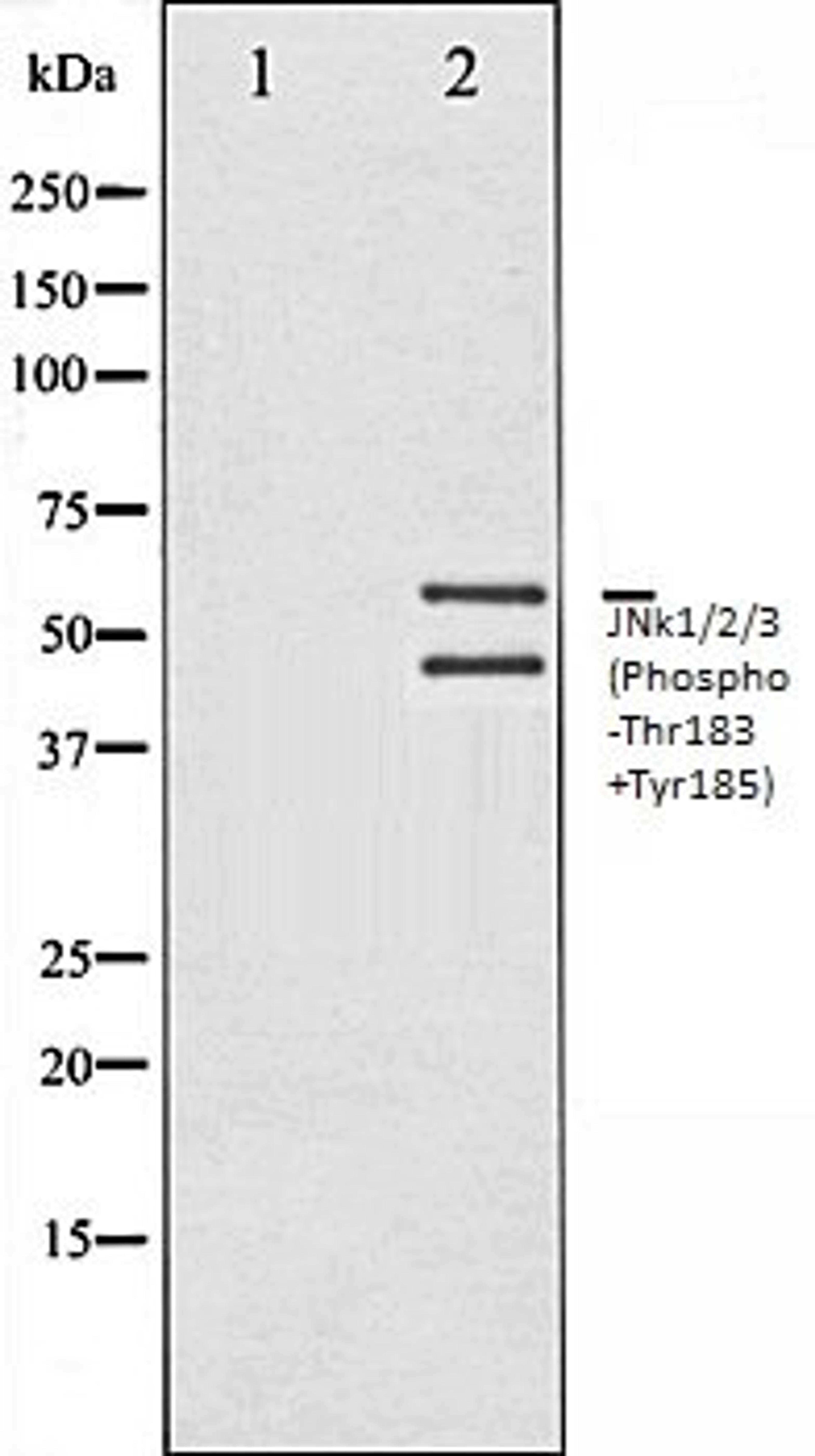 Western blot analysis of 293 whole cell lysates using JNK1/2/3 (Phospho-Thr183+Tyr185) antibody, The lane on the left is treated with the antigen-specific peptide.