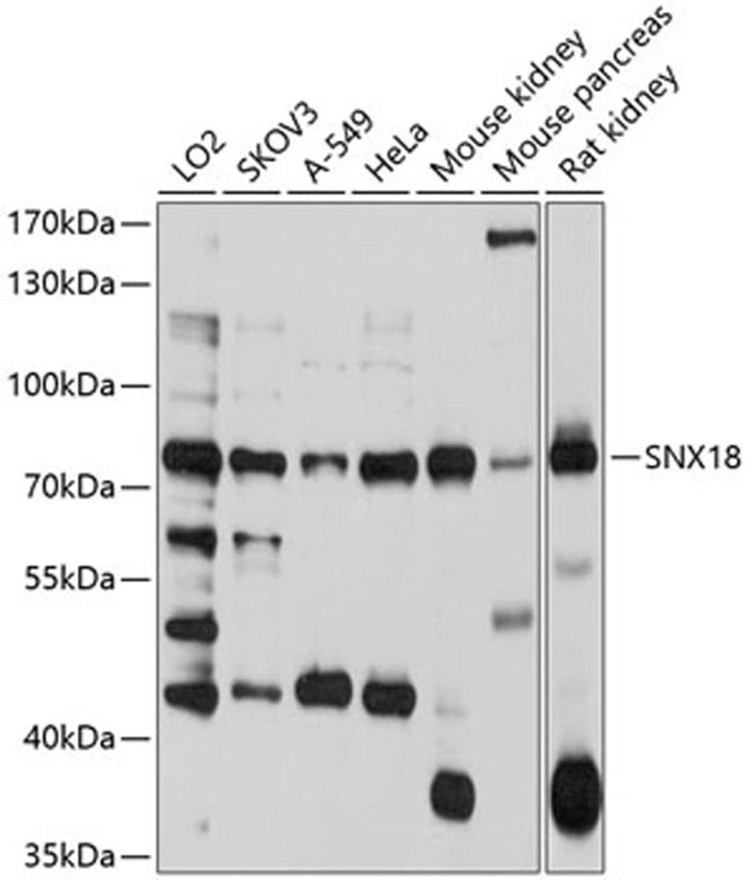 Western blot - SNX18 antibody (A10337)