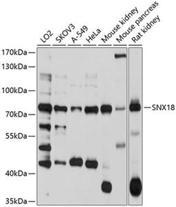 Western blot - SNX18 antibody (A10337)