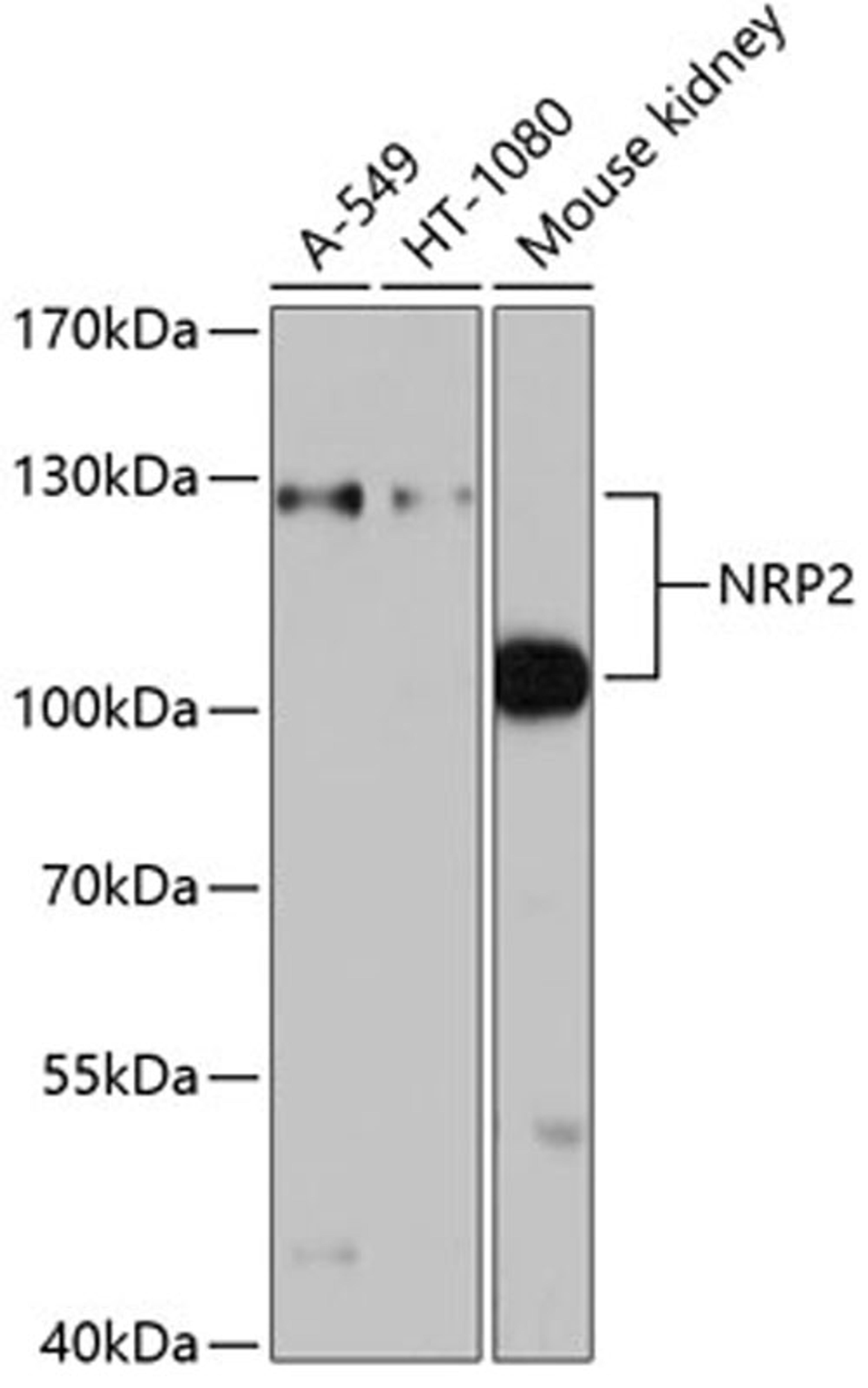 Western blot - NRP2 antibody (A2581)