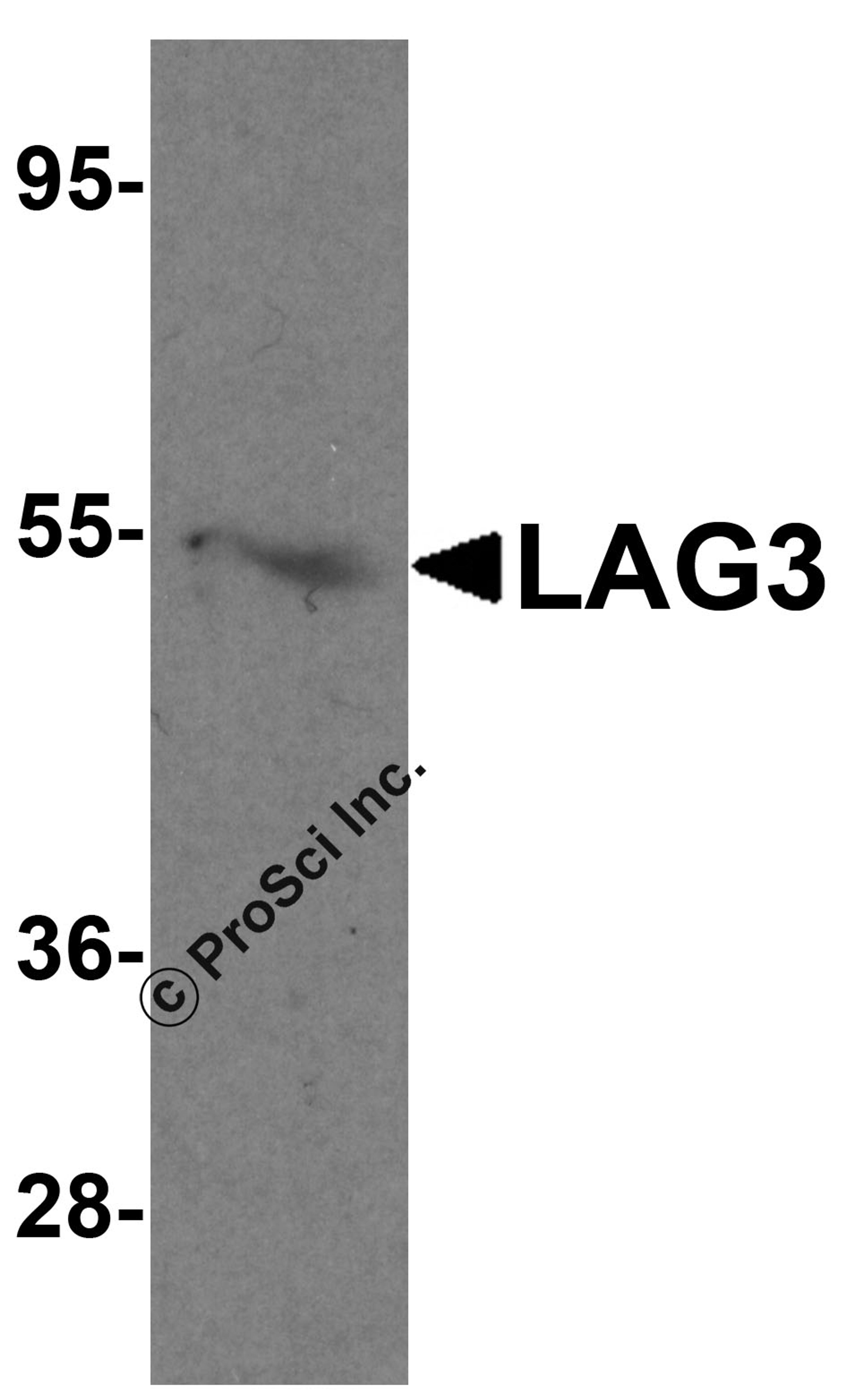 Western blot analysis of LAG3 in mouse liver tissue lysate with LAG3 antibody at 1 μg/mL in (A) the absence and (B) the presence of blocking peptide.