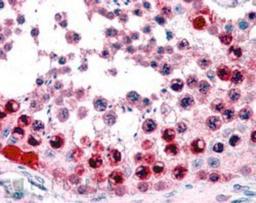 Immunohistochemistry-Paraffin: ATF7 Antibody [NB300-899] - (3.8ug/ml) staining of paraffin embedded Human Testis. Steamed antigen retrieval with citrate buffer pH 6, AP-staining.