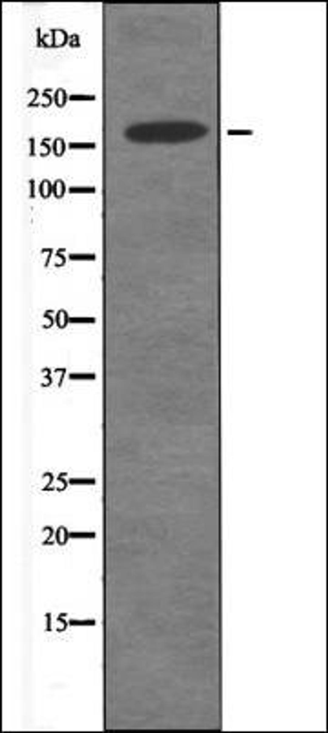 Western blot analysis of A549 whole cell lysates using DAPK1 -Phospho-Ser289- antibody