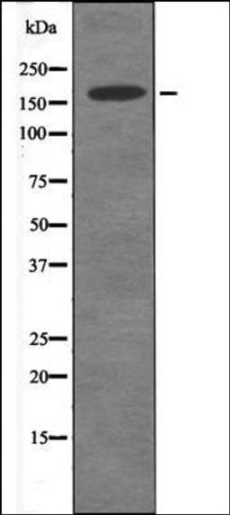 Western blot analysis of A549 whole cell lysates using DAPK1 -Phospho-Ser289- antibody