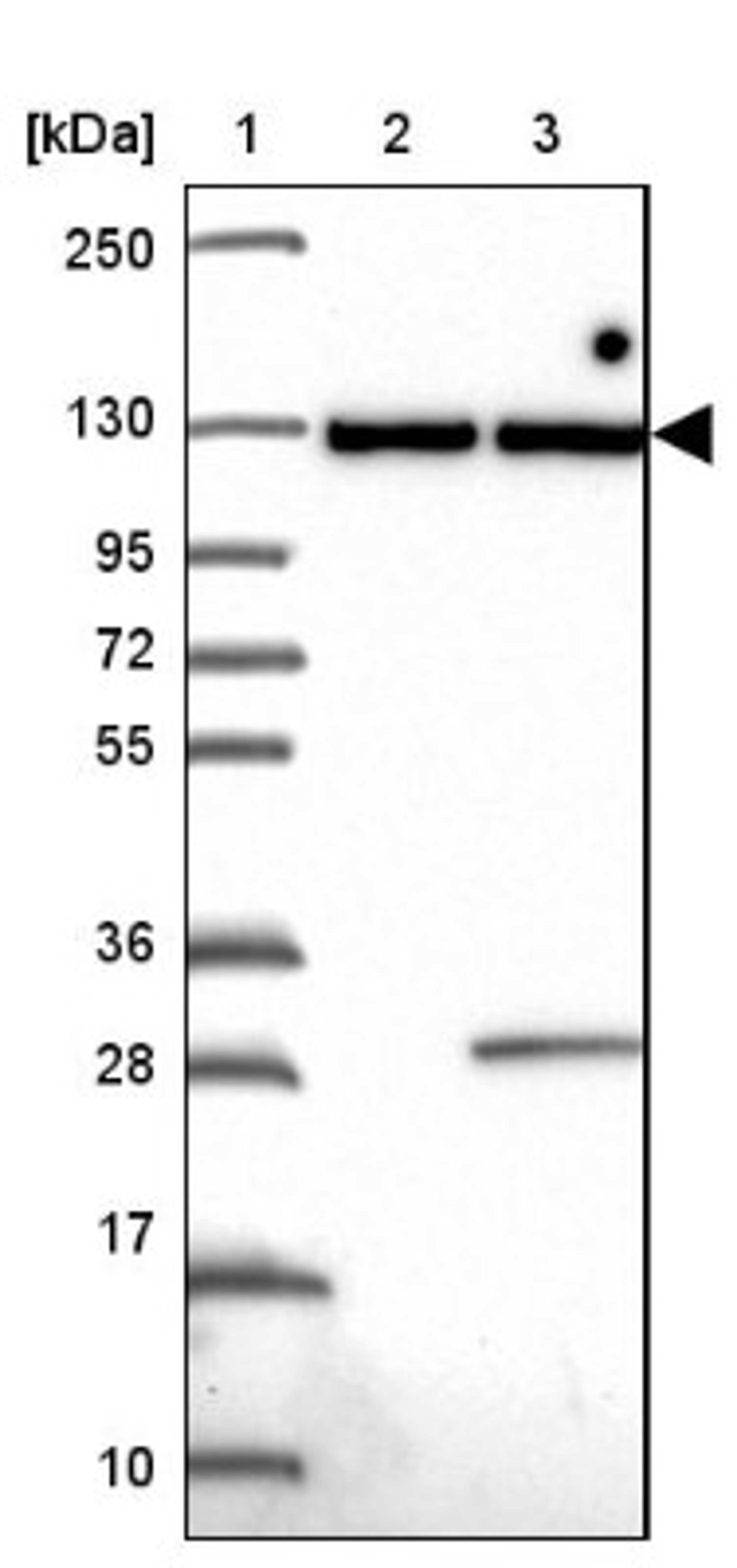 Western Blot: INTS8 Antibody [NBP2-33826] - Lane 1: Marker [kDa] 250, 130, 95, 72, 55, 36, 28, 17, 10<br/>Lane 2: Human cell line RT-4<br/>Lane 3: Human cell line U-251MG sp