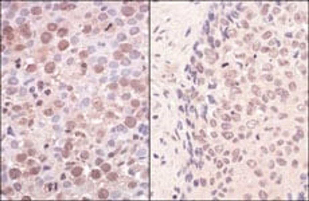 Detection of human SmcHD1 by immunohistochemistry.