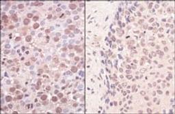 Detection of human SmcHD1 by immunohistochemistry.