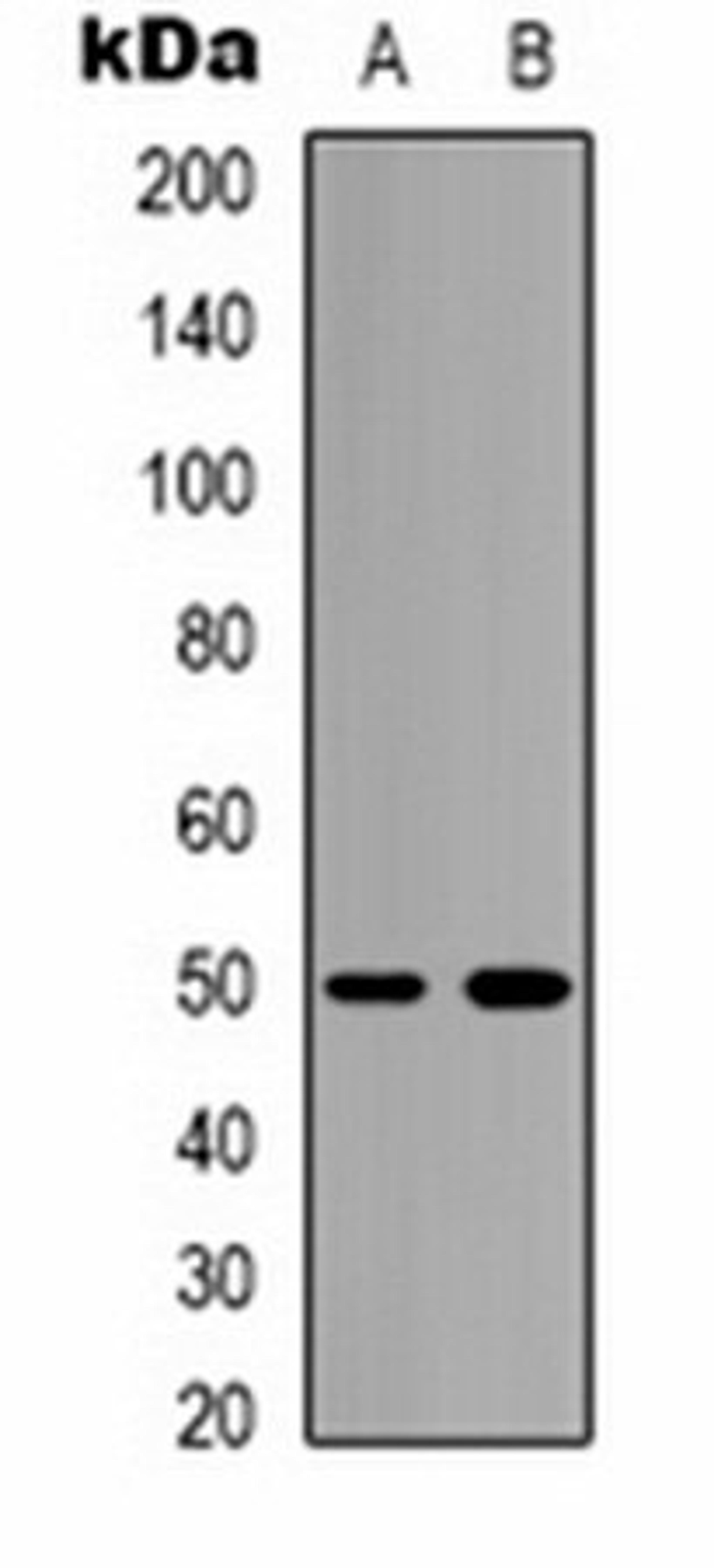 Western blot analysis of mouse brain (Lane 1), rat brain (Lane 2) whole cell lysates using Bestrophin-2 antibody