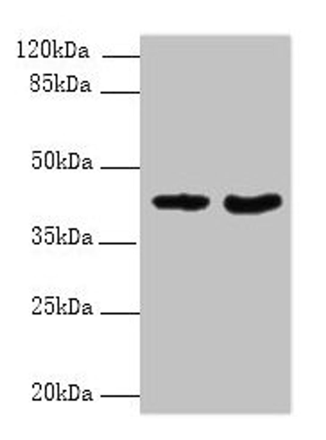 Western blot. All lanes: DMKN antibody at 6µg/ml. Lane 1: Mouse kidney tissue. Lane 2: Mouse liver tissue. Secondary. Goat polyclonal to rabbit IgG at 1/10000 dilution. Predicted band size: 48, 16, 37, 46, 39, 42, 36, 21, 19, 17, 15, 10, 47 kDa. Observed band size: 42 kDa