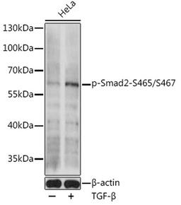 Western blot - Phospho-Smad2-S465/S467 antibody (AP0925)