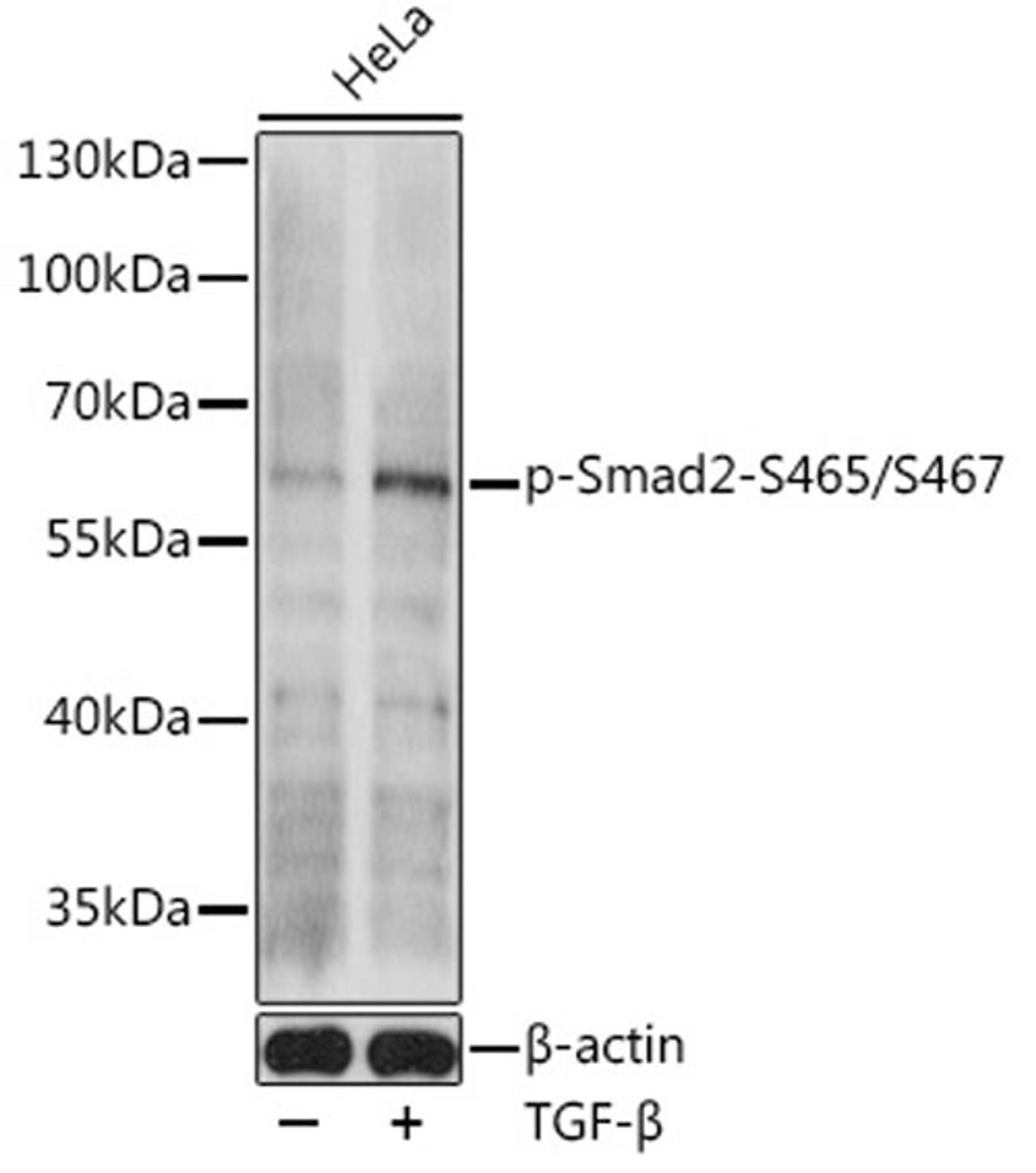 Western blot - Phospho-Smad2-S465/S467 antibody (AP0925)