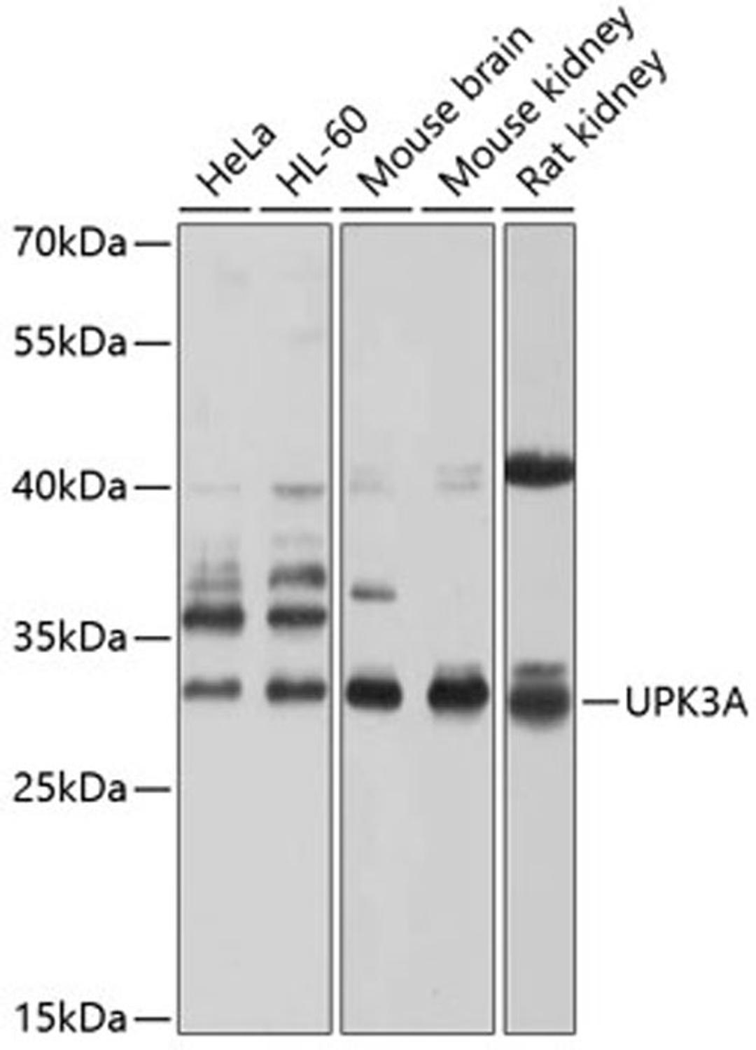 Western blot - UPK3A antibody (A10034)