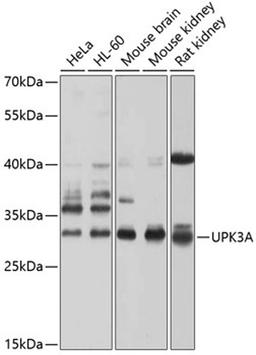 Western blot - UPK3A antibody (A10034)