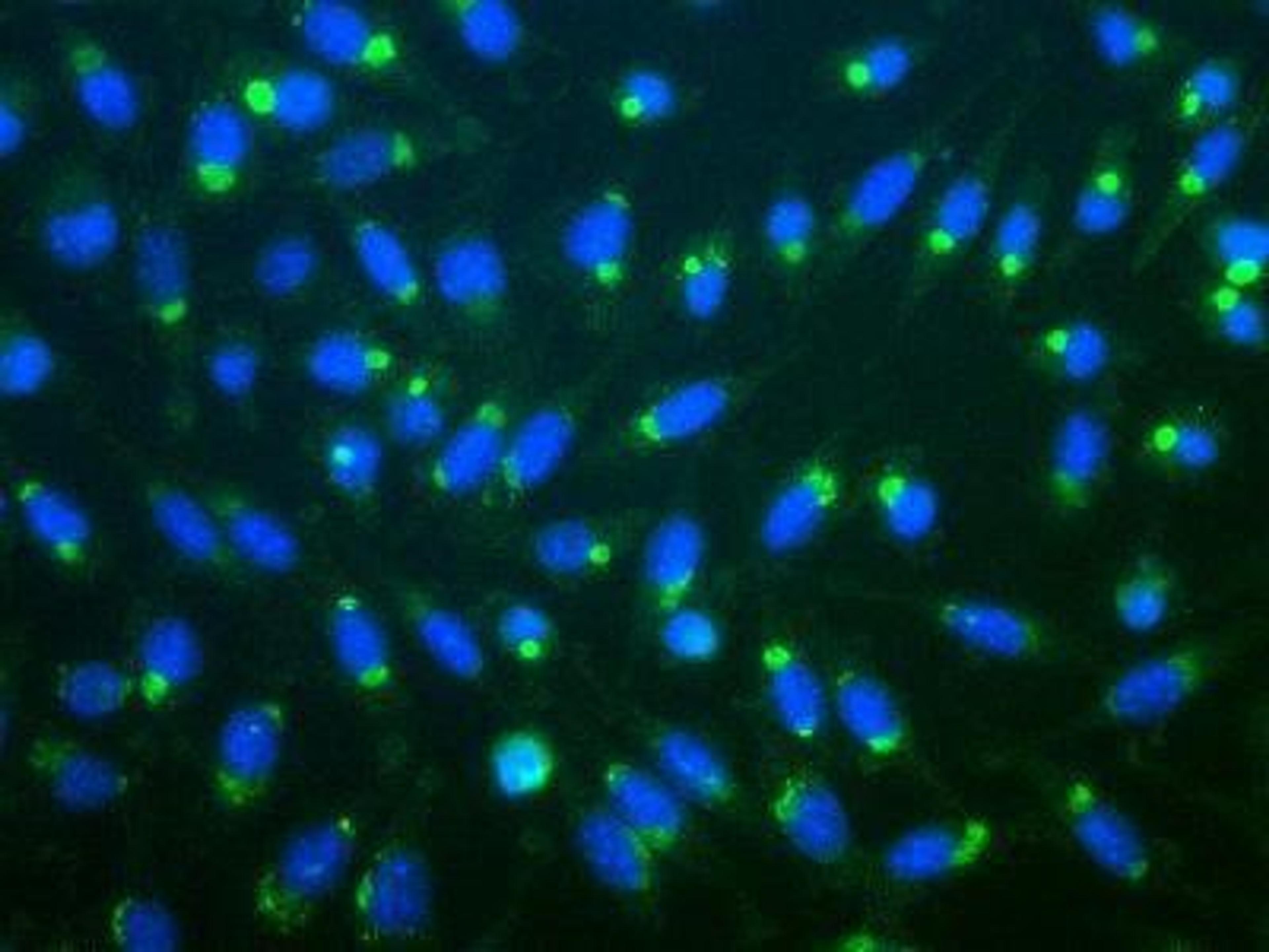 Immunocytochemistry/Immunofluorescence: Ubiquitin Antibody [NB300-129] - Immunofluorescent staining of aggresomes of mouse L-cells treated with lactacysteine, using NB300-129.