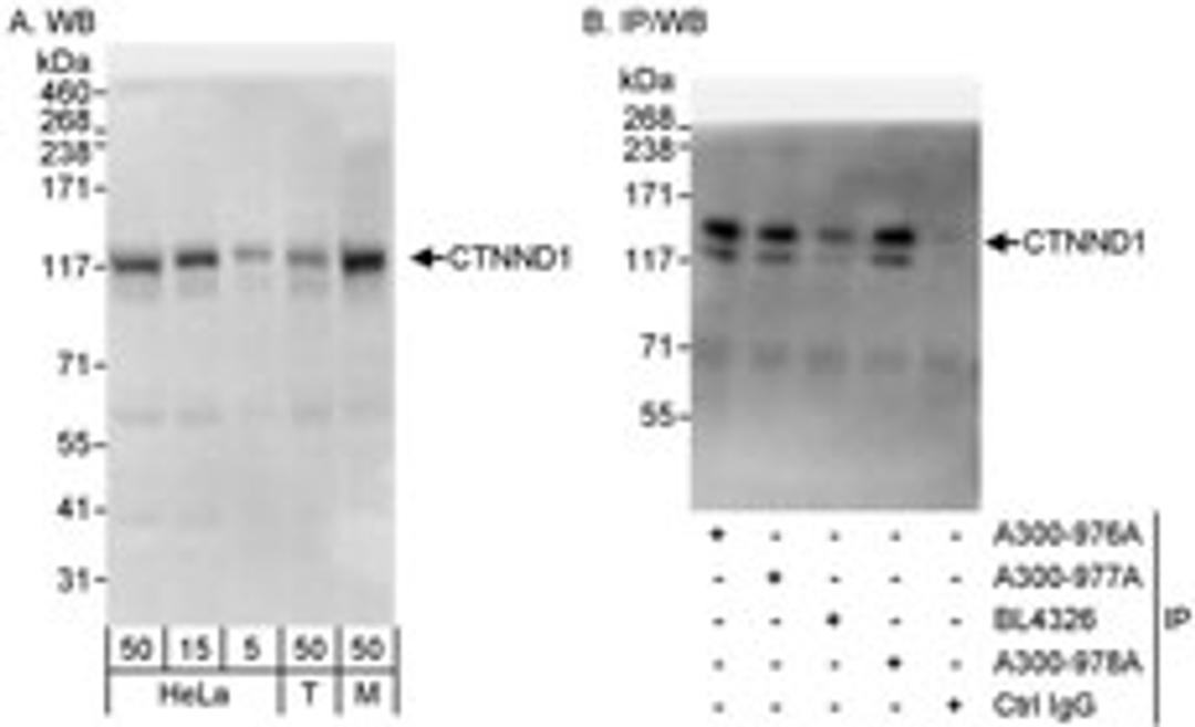 Detection of human and mouse CTNND1 by western blot (h&m) and immunoprecipitation (h).