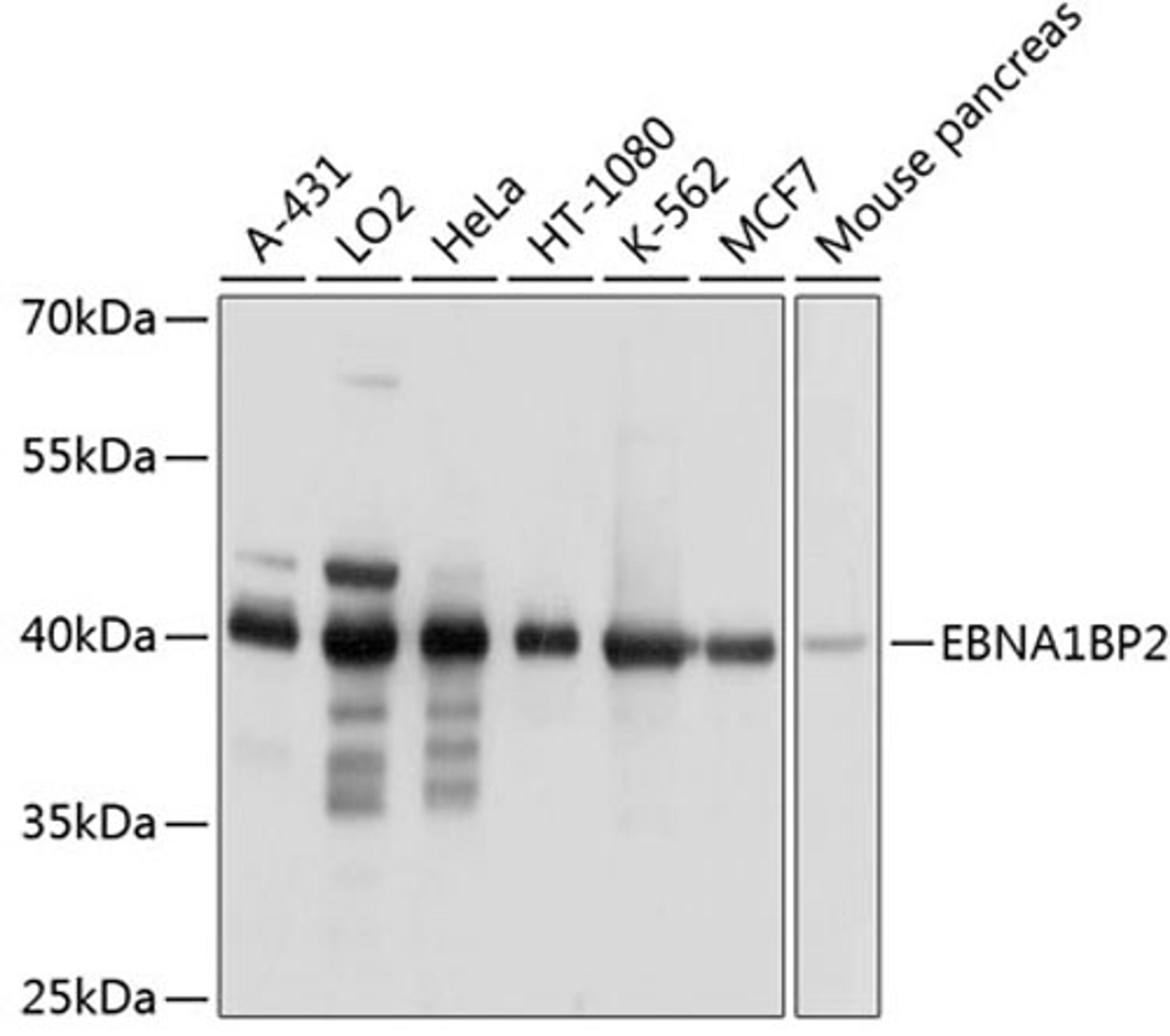 Western blot - EBNA1BP2 antibody (A9153)