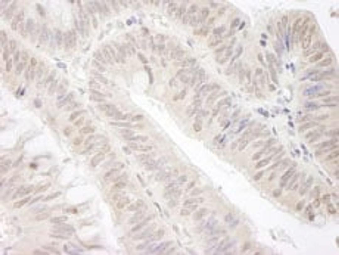 Detection of human Gemin4 by immunohistochemistry.