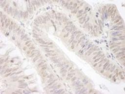 Detection of human Gemin4 by immunohistochemistry.