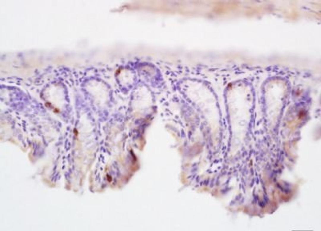 Immunohistochemical analysis of formalin-fixed paraffin embedded mouse intestine tissue using CIDE A antibody (dilution at 1:200)