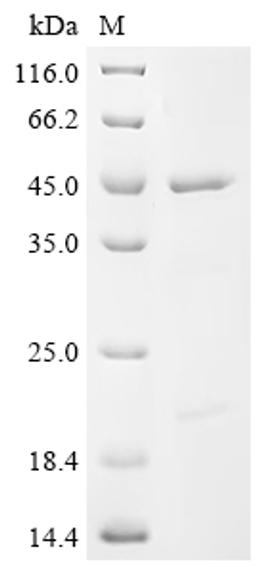 (Tris-Glycine gel) Discontinuous SDS-PAGE (reduced) with 5% enrichment gel and 15% separation gel.