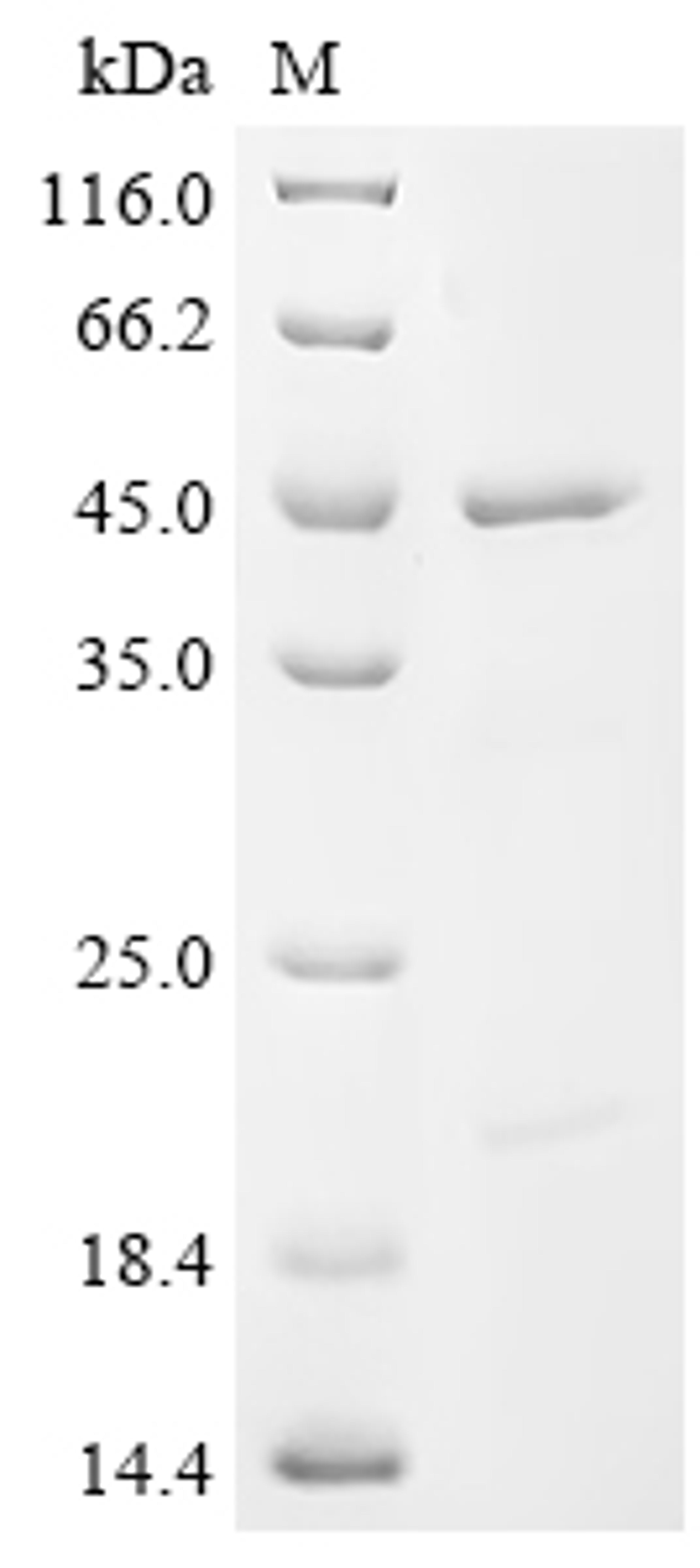 (Tris-Glycine gel) Discontinuous SDS-PAGE (reduced) with 5% enrichment gel and 15% separation gel.