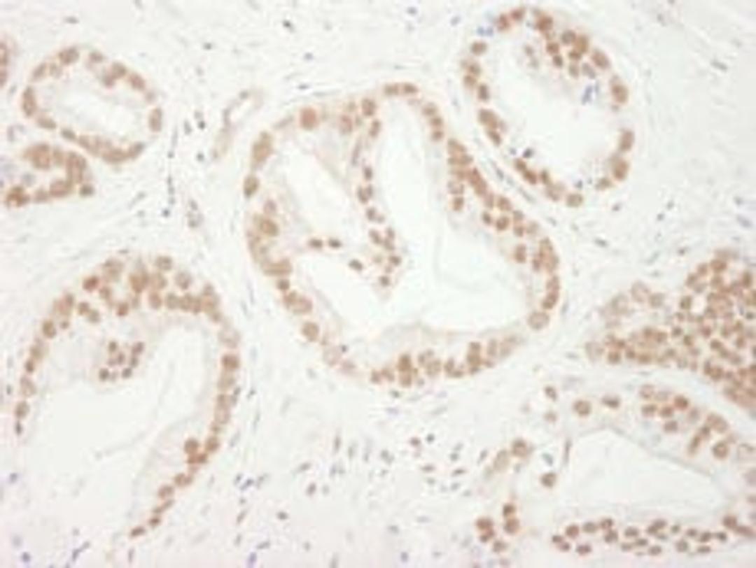 Detection of human Bub3 by immunohistochemistry.